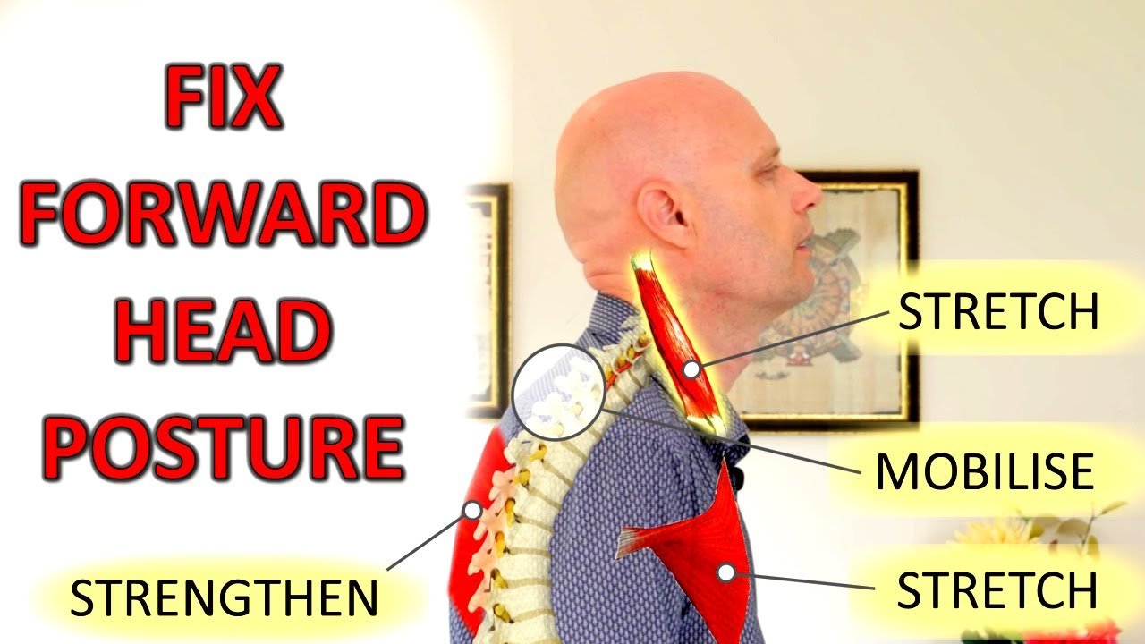 Correcting Forward Head Posture: A Guide to Realigning Your Neck and Spine